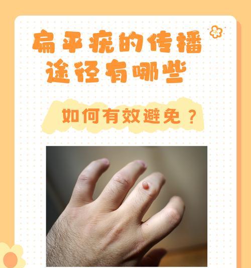 文章详情图片