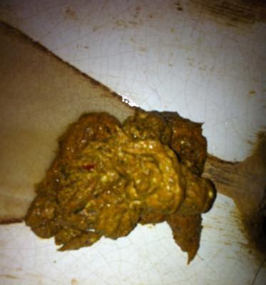 文章详情图片