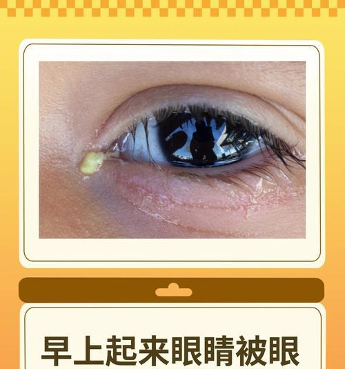 文章详情图片