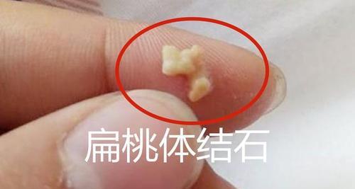 文章详情图片