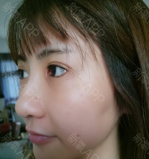 文章详情图片