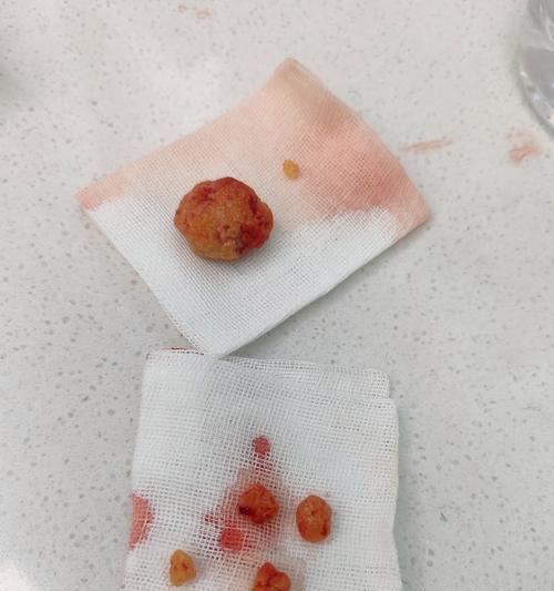 文章详情图片