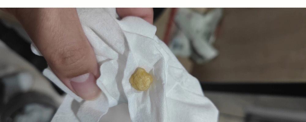 文章详情图片