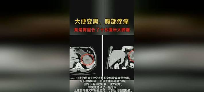 文章详情图片