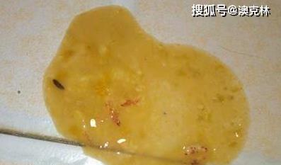 文章详情图片