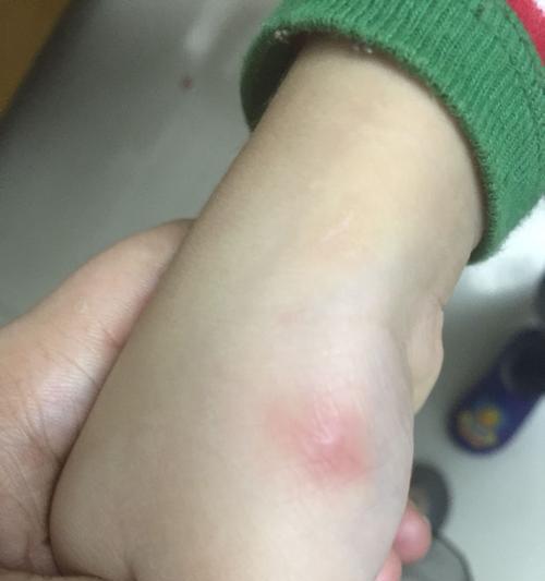 文章详情图片