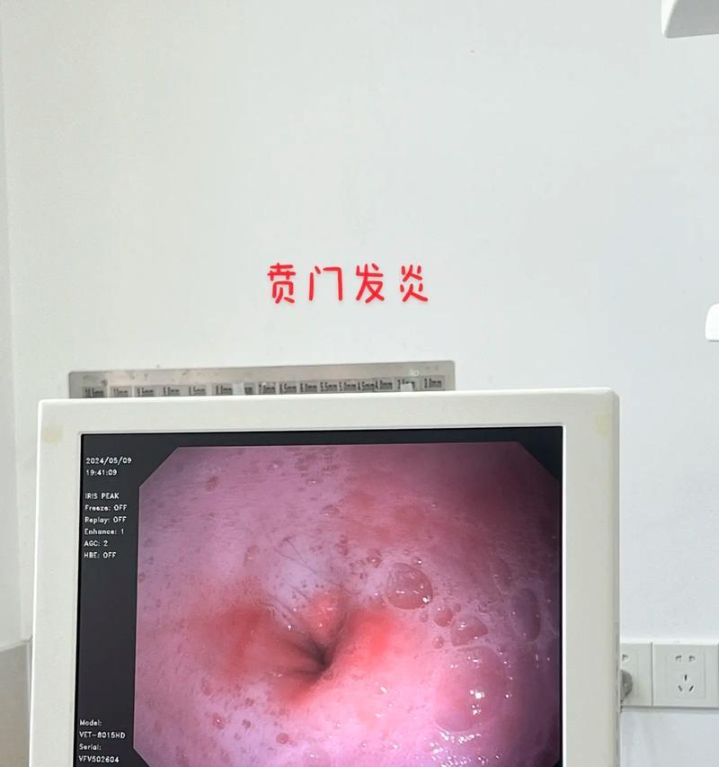 文章详情图片