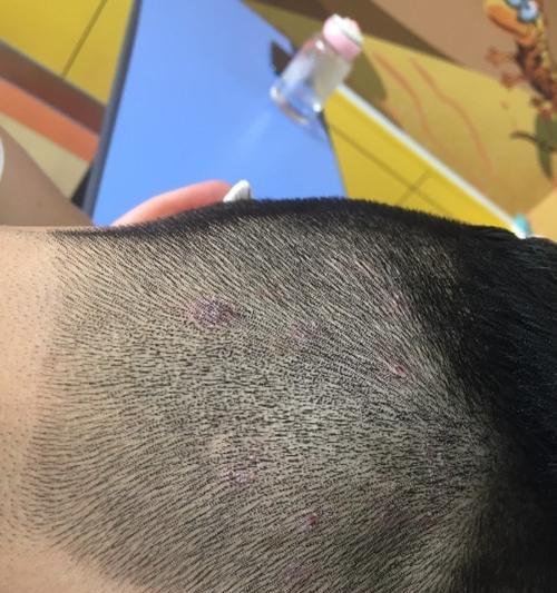 文章详情图片