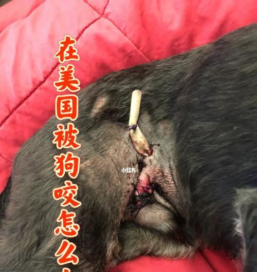 文章详情图片